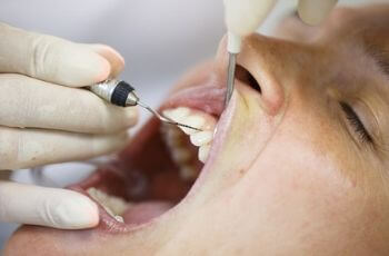 Dentist working on Mouth